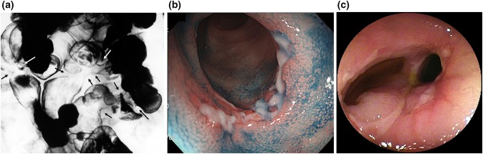 Fig. 2