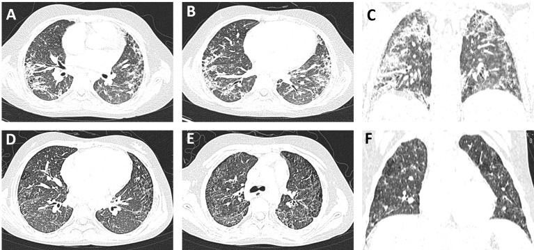 Figure 2