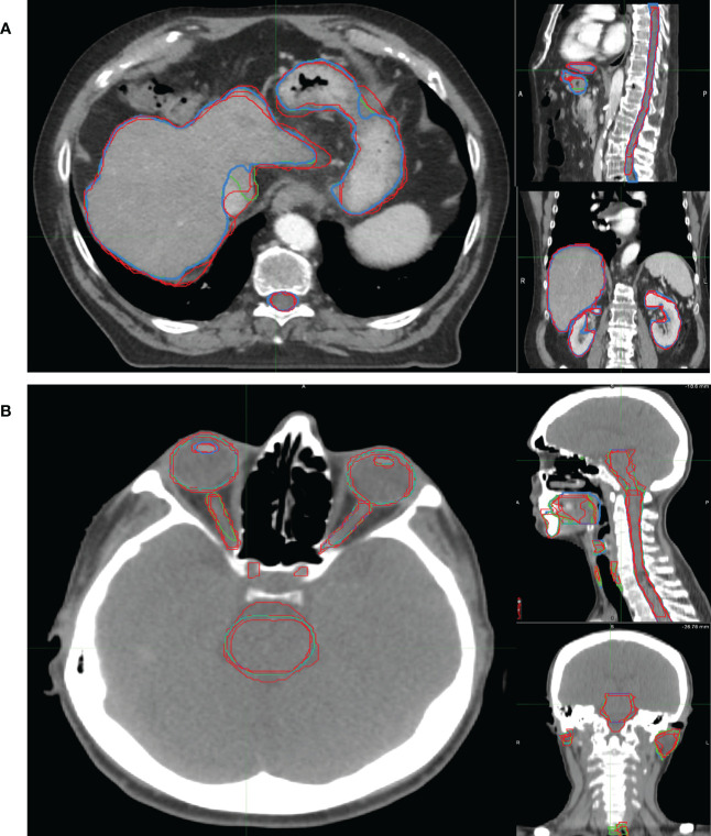 Figure 3