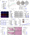 Figure 2. Knockdown of LINC00467 suppresses GC cell proliferation and invasion in vitro and in vivo . HGC27 cells exhibited (A) reduced LINC00467 expression following si–LINC00467 transfection and led...