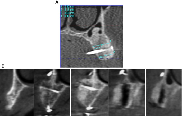 Fig. 4