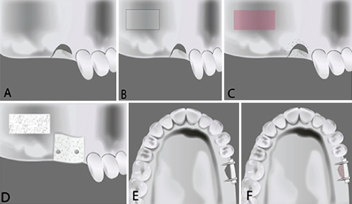 Fig. 2