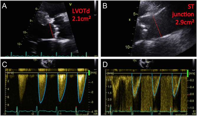 Figure 12