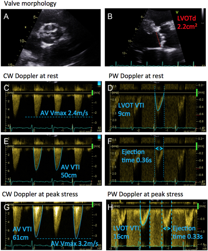 Figure 17