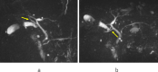 Fig 1 –
