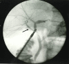 Fig 3 –