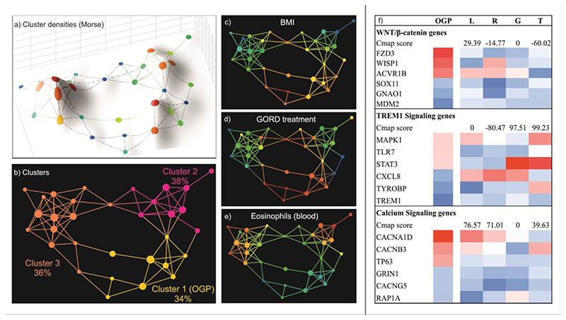 Severe asthma clusters based on epithelial transcriptomics.