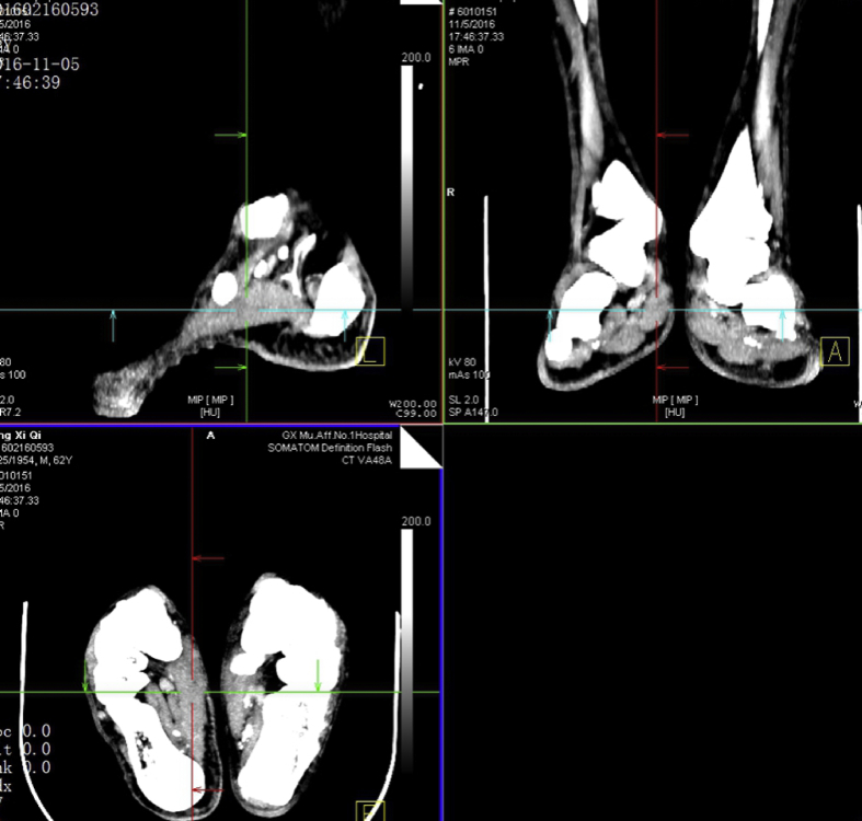 Figure 3