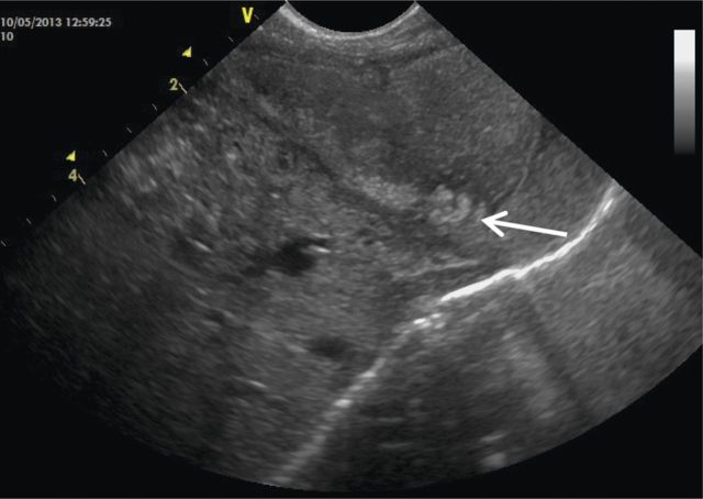 Figure 3: