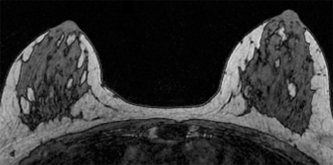 Figure 3d: