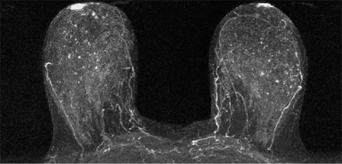 Figure 1c: