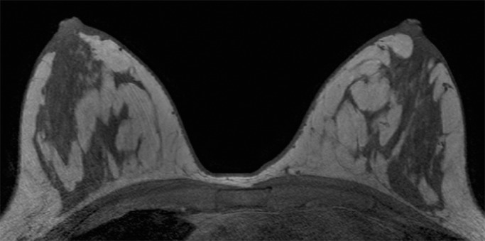 Figure 3c: