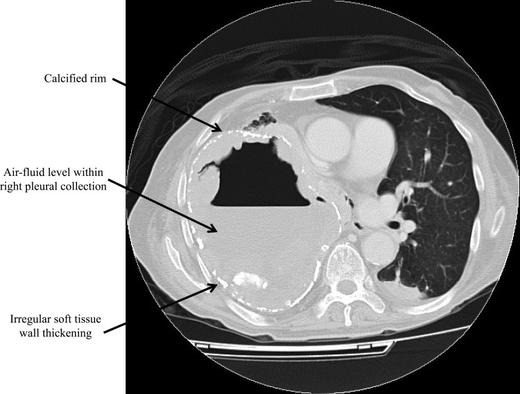 FIG 1