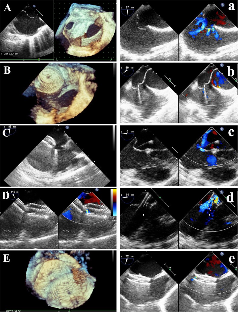 Fig. 4