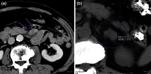 Fig. 5