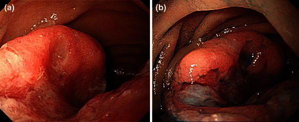 Fig. 4