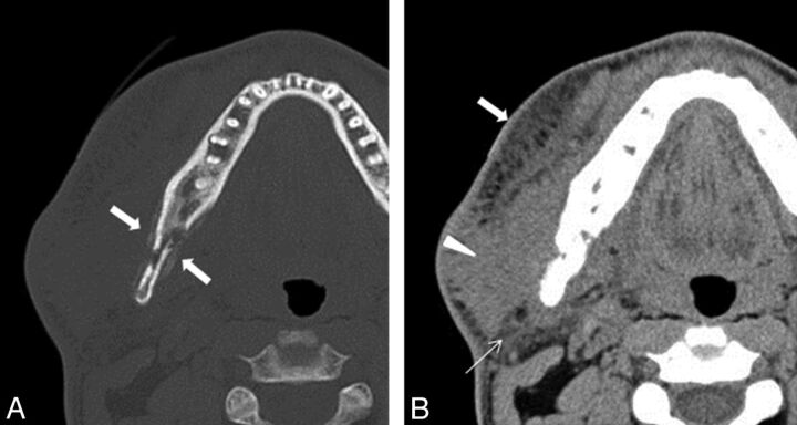 Fig 3.