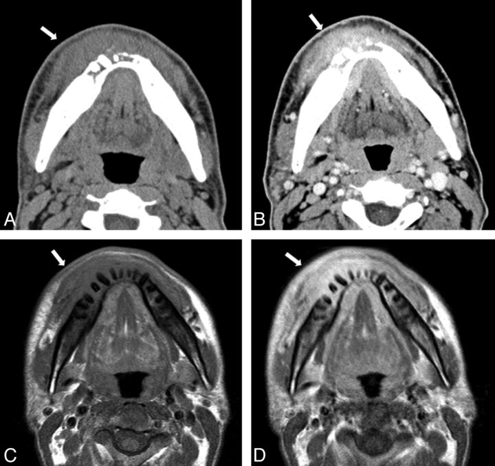 Fig 2.