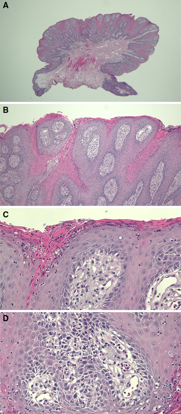 Fig. 2