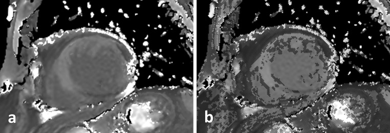 Fig. 4