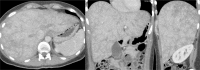 Fig 1 –
