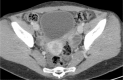 Fig 3 –