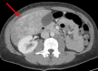 Fig 2 –