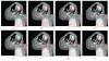 Fig. 11