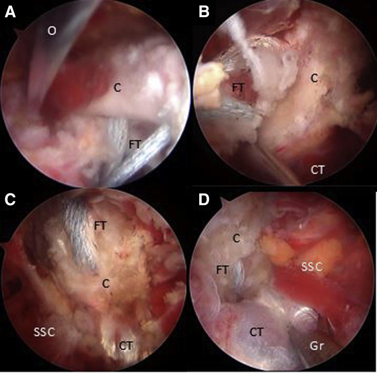 Fig 10