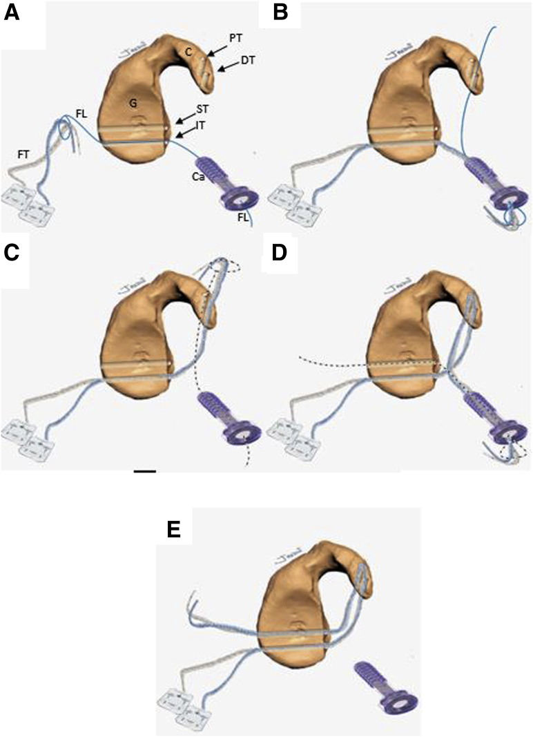 Fig 9