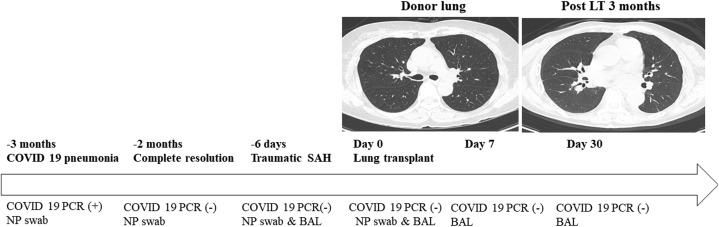 Figure 1