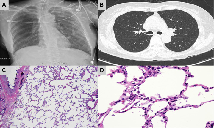 Figure 2