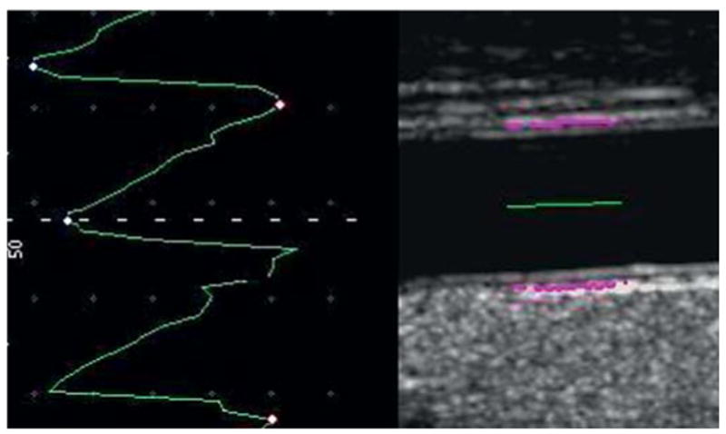 Fig. 4