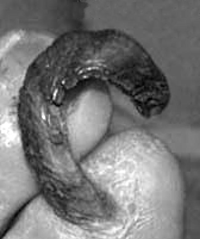 graphic file with name om27565.f2.jpg