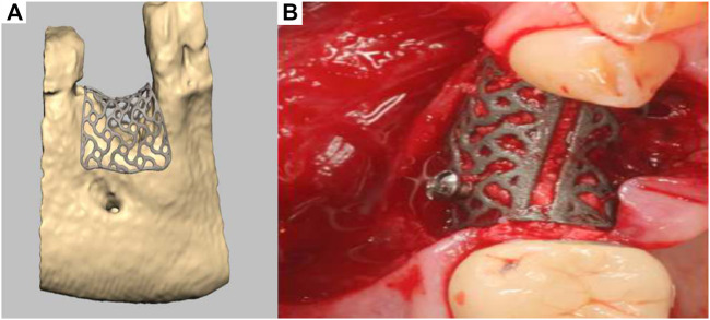 FIGURE 11