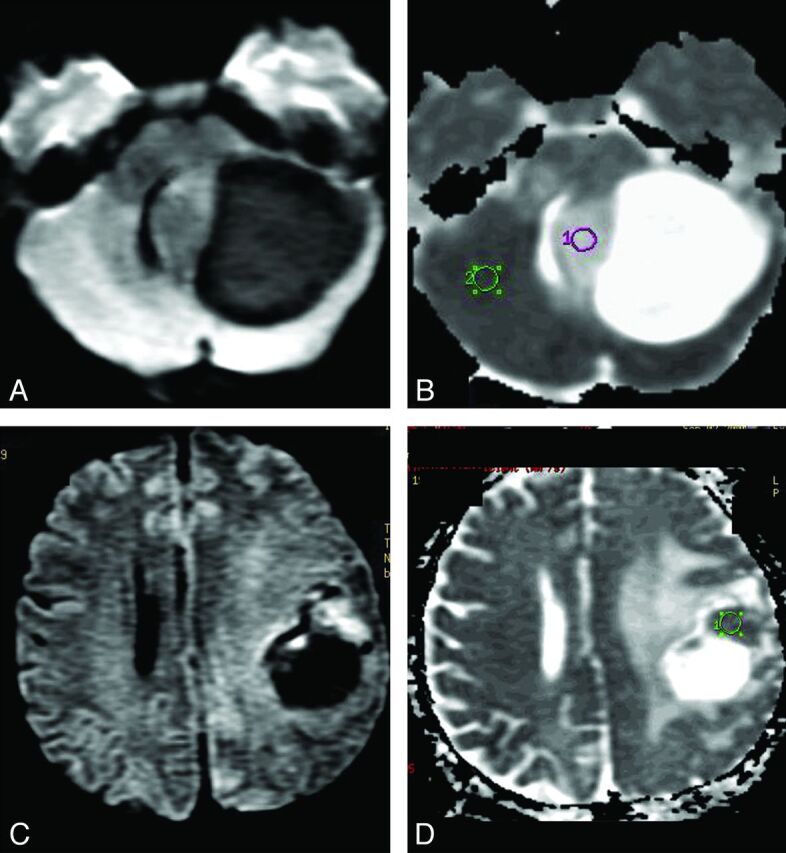 Fig 2.