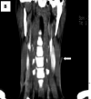 Fig 2. B