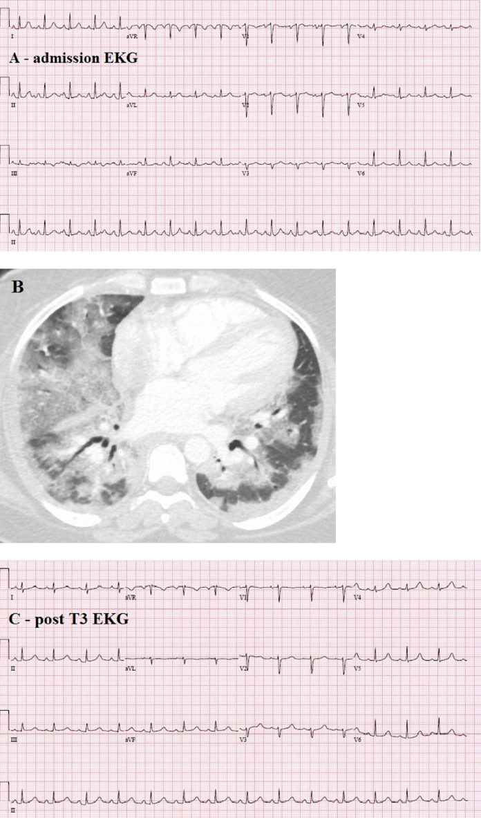 Fig. 1