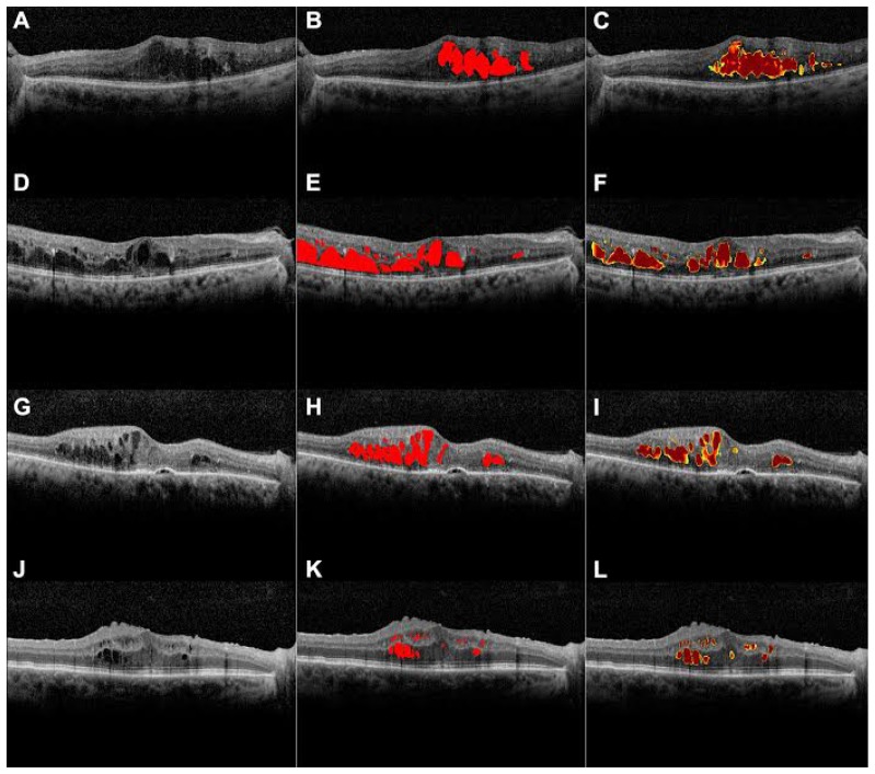 Fig. 4