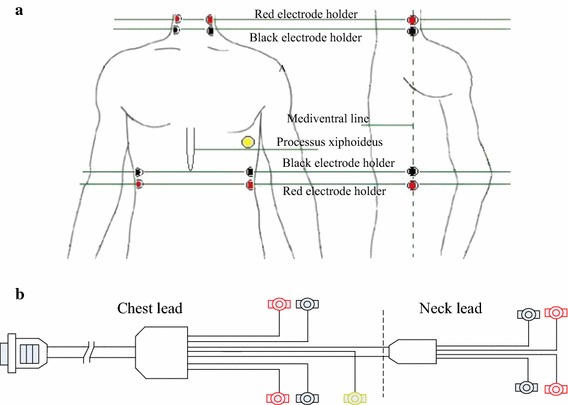 Fig. 1