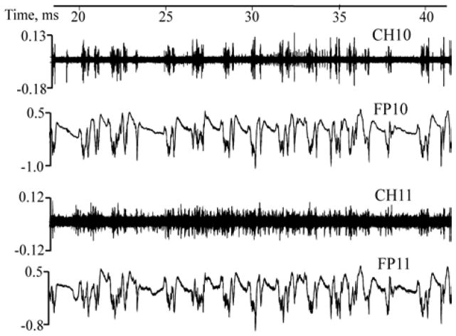 Figure 11