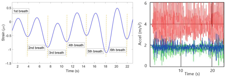 Figure 25