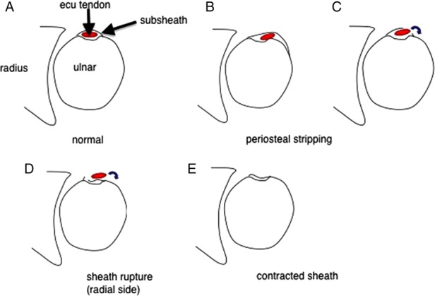 Figure 4