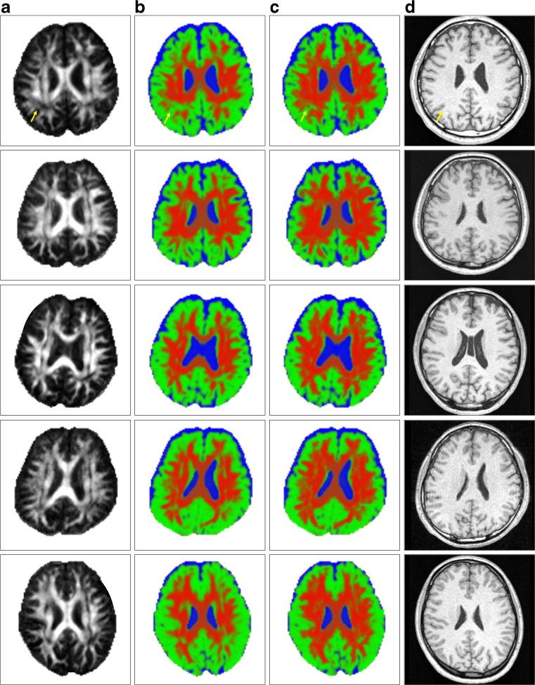 Fig. 4