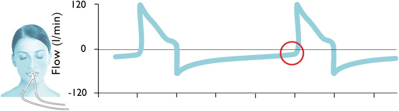 Fig. 3