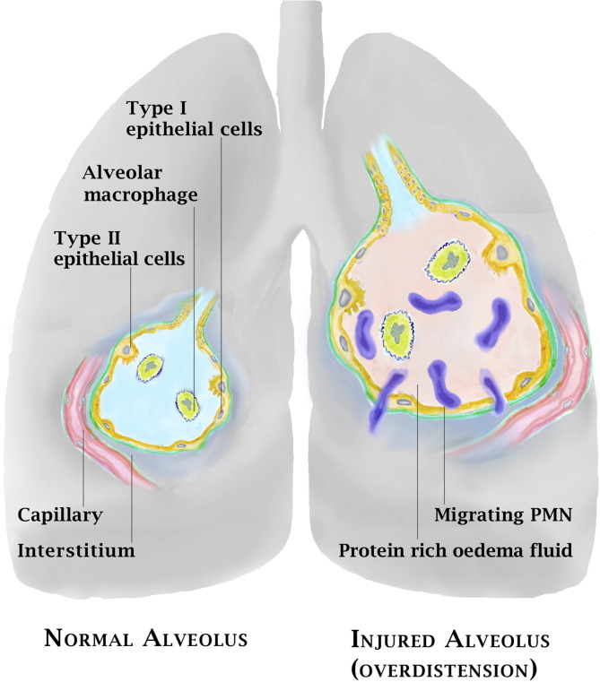 Fig. 1