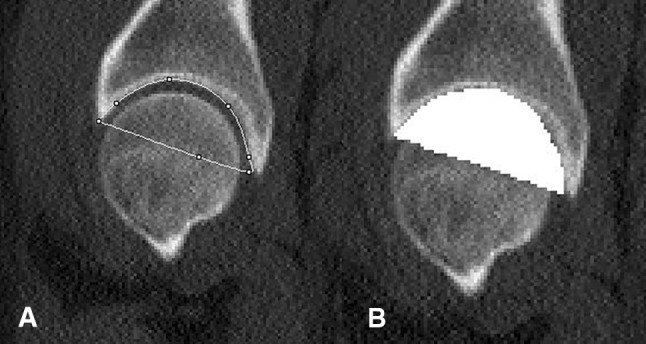 Fig. 1A–B