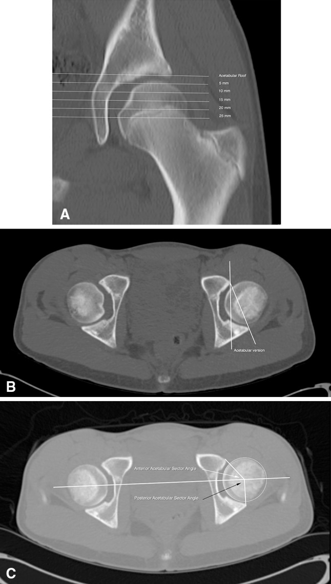 Fig. 4A–C