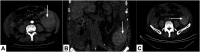 FIGURE1