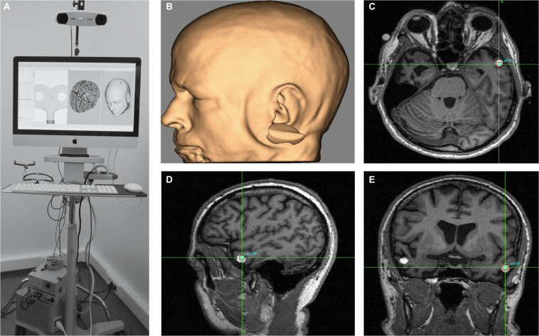 FIGURE 5